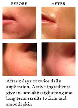 Venom Wrinkle Anti-dote