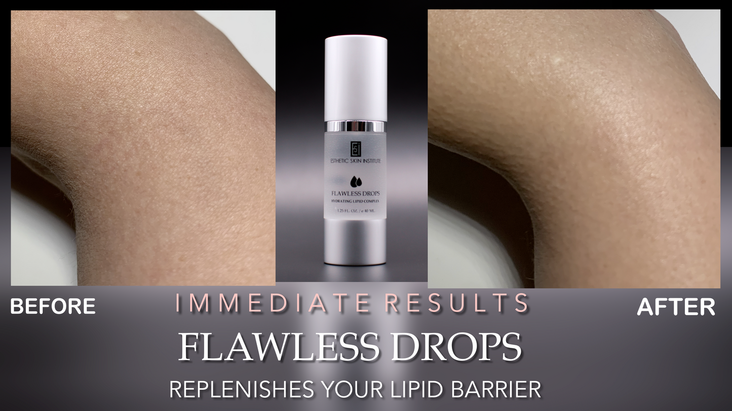 Flawless Drops